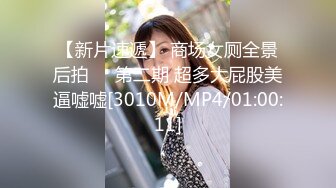 潜入医院偷拍来做检查的美少妇 (1)